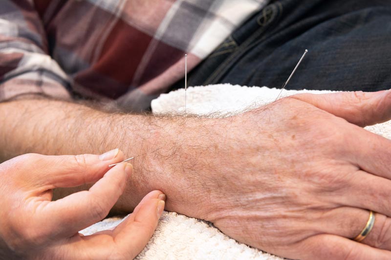 Acupunctuur in Lelystad door Liesbeth Kerkhoff van Arjama gezondheidspraktij en kookstudio